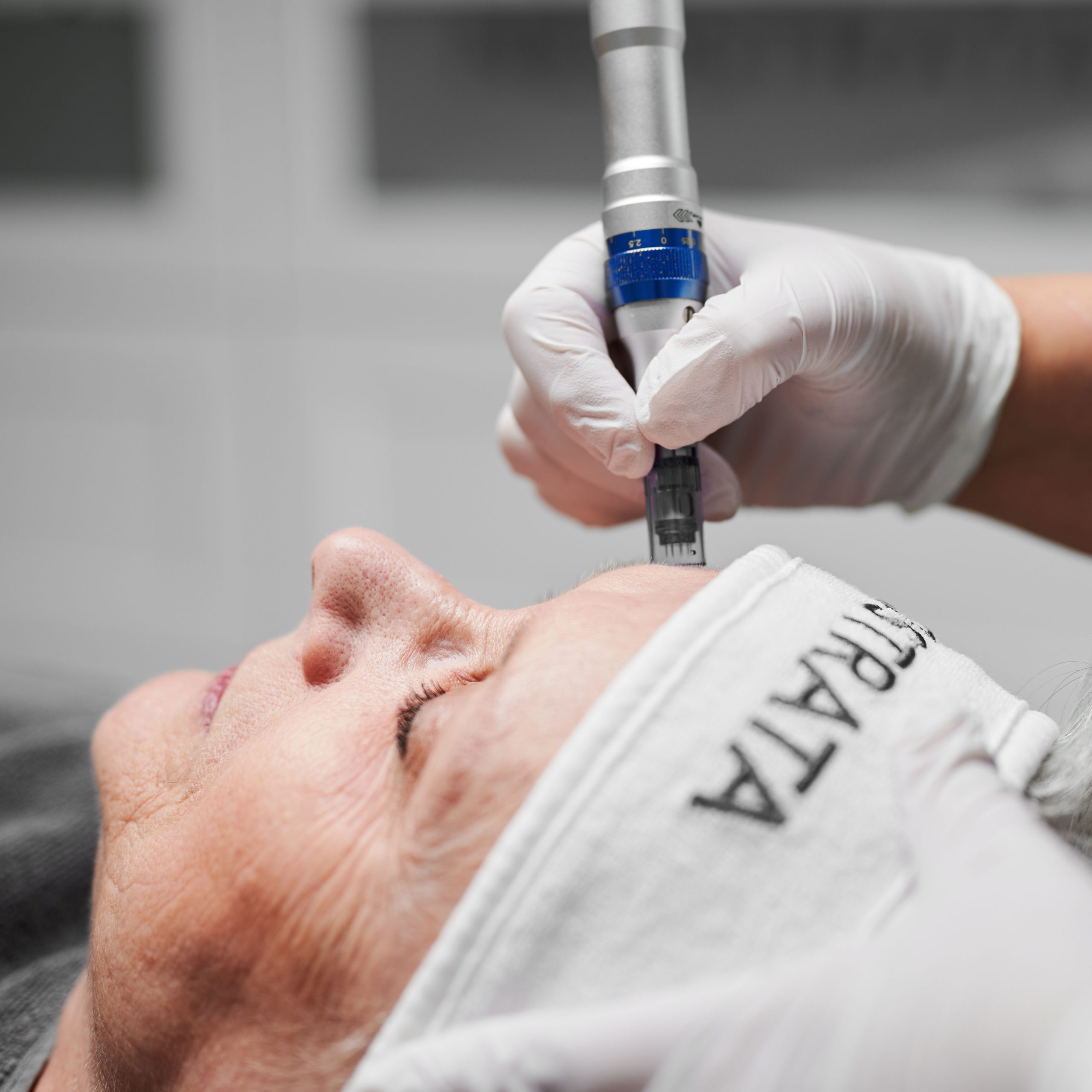 Microneedling 4 Microneedling panna